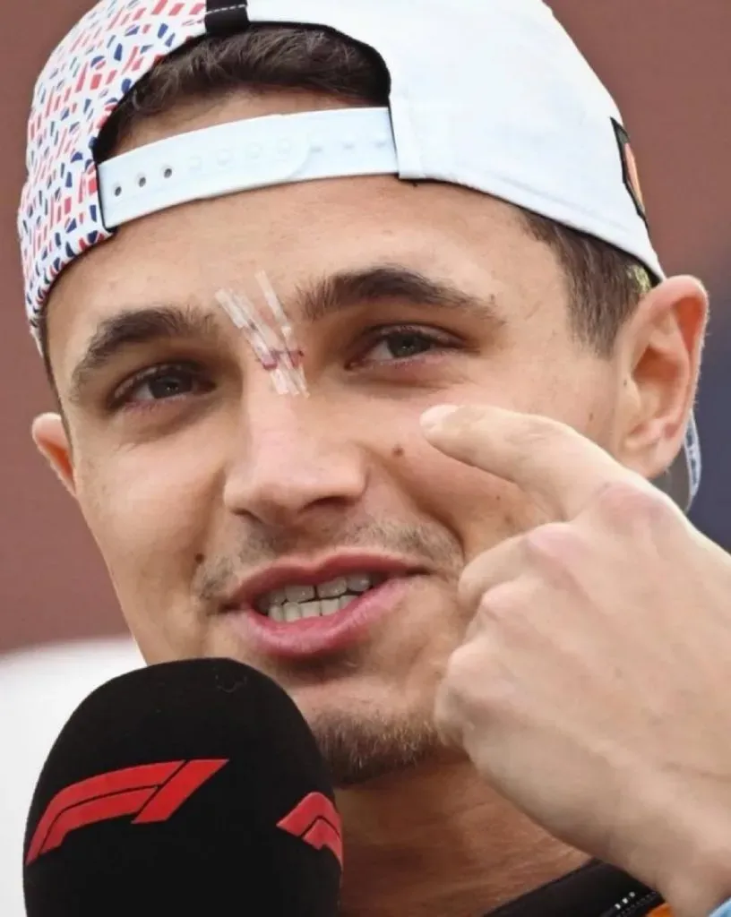 Así quedó la nariz de Lando Norris. (Foto: AlertaF1)
