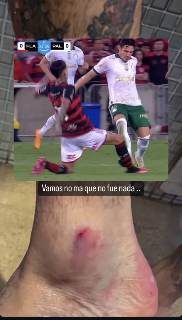 Así quedó el tobillo de Erick Pulgar tras el fuerte planchazo ante Palmeiras. Foto: Instagram.