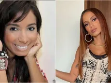 Anitta faz comparação com seu antes e depois: “Não era linda”