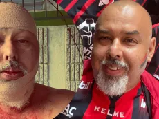 “Me querían matar”: aficionado de Alajuelense detalla la barbarie sufrida en Comunicaciones