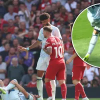 VIDEO  Mac Allister se fue expulsado en Liverpool por un fuerte planchazo