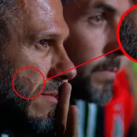 ¿Qué le pasó a Martín Demichelis en la cara?