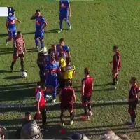 Fernando Brandán mostró cómo le quedó el ojo tras el botellazo que suspendió Tigre – Chacarita