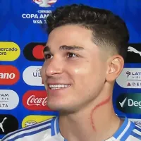 El impactante rasguño que le hicieron a Julián Álvarez: \'A veces toca luchar\'