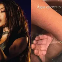 Ludmilla pede socorro para remover pulseira 'teimosa' após show em Recife