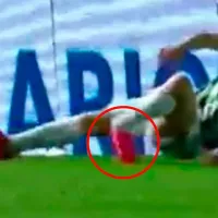 La imagen es escalofriante: la terrible lesión del Kitu Díaz con Banfield