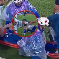 Impresionante lesión de Andrés Llinás contra Deportivo Cali: Imágenes sensibles