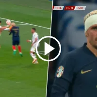 VIDEO  Casi le arrancan la oreja a Griezmann con violenta patada