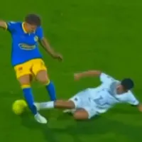 Escalofriante: así quedó la pierna de Igor Lichnovsky tras la dura entrada de Piero Quispe