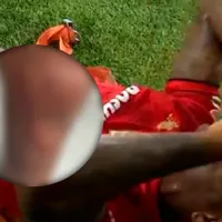 Dura imagen: Helinho exhibió la herida por la brutal entrada de Lichnovsky en Toluca – América