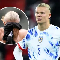 Con puntos de sutura: así quedó el rostro de Erling Haaland tras impactar contra un autobús