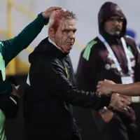 La horripilante razón por la que Honduras jugará a puertas cerradas contra Bermudas