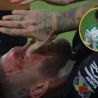 La alarmante estadística de Choco Lozano que asusta a Honduras tras la brutal patada a Sergio Ramos que le partió la cara