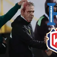 Concacaf hace advertencia a Honduras: el horripilante motivo por el que puede ser castigado ante Costa Rica