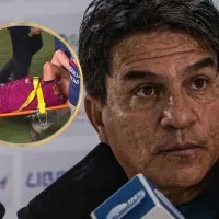 Vladimir Quesada confirma lo peor: los detalles de la lesión de Óscar Duarte