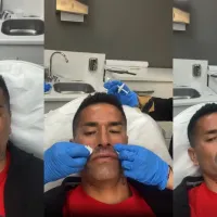 Kike Acuña bravo para el bótox transmite tratamiento estético ¡por Instagram!