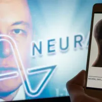 ¡Impresionante! Elon Musk anuncia el primer caso de implante con el chip cerebral \&#039;Telepathy\&#039;