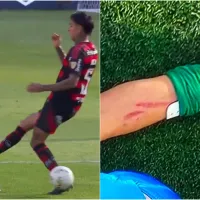 "Se le salió...": A Pulgar no lo expulsan de milagro en Libertadores