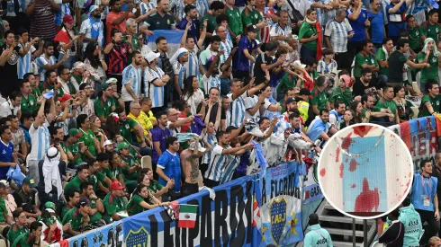 Impactante: un hincha argentino mostró cómo le quedó la cara tras la pelea con los mexicanos