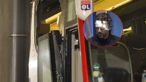 Grosso fue herido en la previa del clásico de Marsella y Lyon.