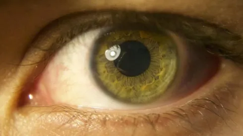 Imagem: Reprodução/Pixabay
