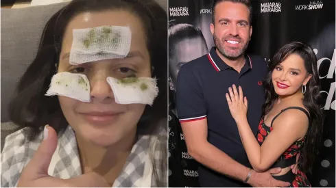 Maraisa com ervas medicinais no rosto e Maraisa posando com o noivo antes de um show – Fotos: Instagram/Maraisa
