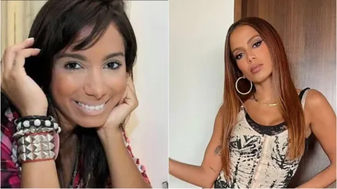 Fotos: Anitta fala sobre suas plásticas – Reprodução/ Instagram
