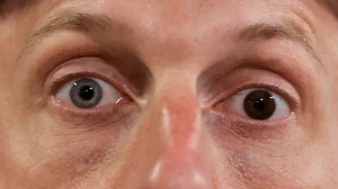 Max Scherzer eyes
