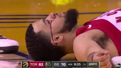 ¡Ouch! Le rompieron la cara a VanVleet con un terrible codazo en las Finales