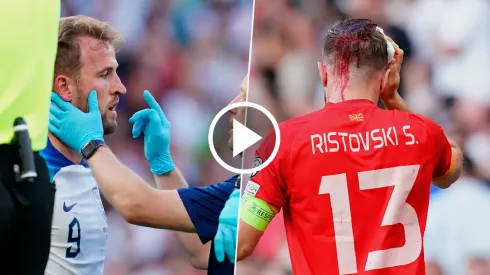 VIDEO | Kane protagonizó un durísimo choque de cabezas