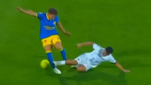 Escalofriante: así quedó la pierna de Igor Lichnovsky tras la dura entrada de Pedro Quispe