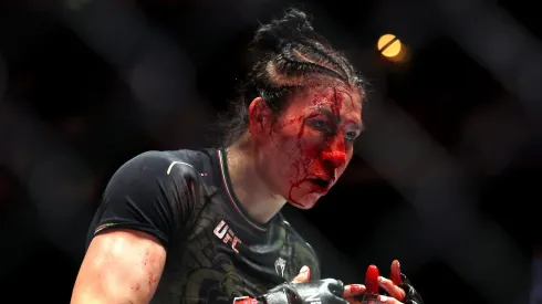 Irene Aldana terminó con el rostro irreconocible en UFC 306.
