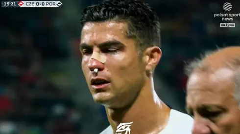 ¡Lleno de sangre! Así quedó el rostro de Cristiano tras fuerte choque. (Foto: Captura de video)
