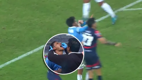 Jhilmar Lora se queda sin diente en pleno juego ante Cerro Porteño.