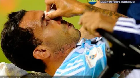 Parte médico de Tevez