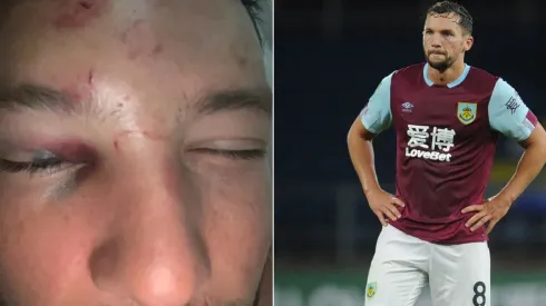 El rostro desfigurado de Drinkwater fue portada este domingo en la prensa inglesa
