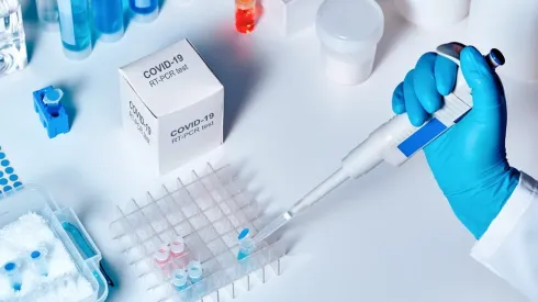 Aseguran que hay stock para hacer exámenes por coronavirus.
