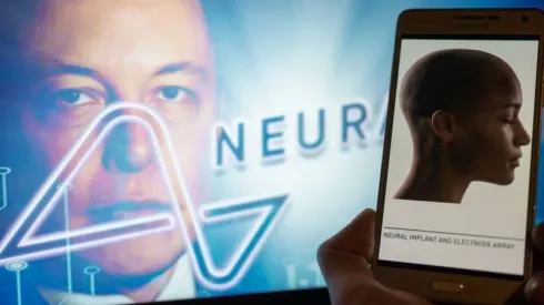 ¡Como en Black Mirror! Elon Musk lanza novedoso chip cerebral.
