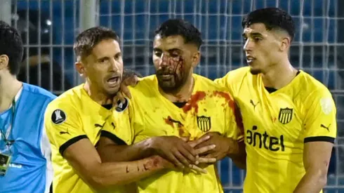 Maximiliano Olivera de Peñarol recibe proyectil en el rostro en el duelo contra Rosario Central.
