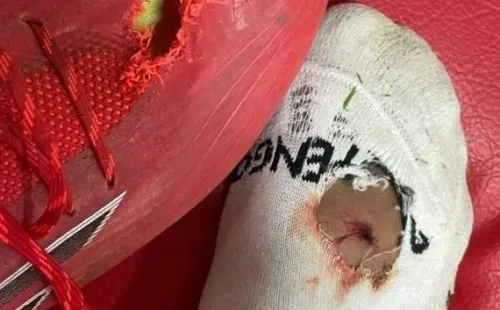 Na derrota por 1 a 0 o Peixe pouco criou e acabou eliminado nas quartas de final. (Foto: Reprodução/Instagram)