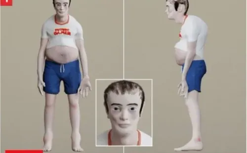Deformidades en el cuerpo