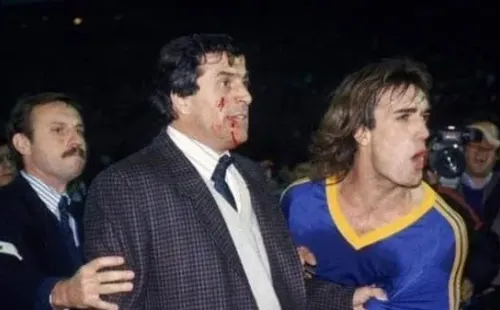 El Maestro Tabárez sangrando en el Monumental.