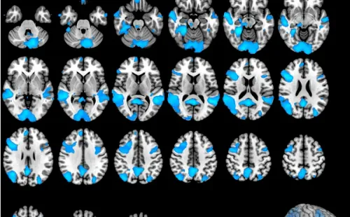 Cerebro