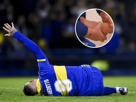 No apto para impresionables: Benedetto mostró como tiene el tobillo