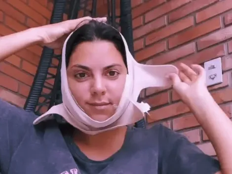 Belu Lucius se sometió a un retoque estético y mostró los sorprendentes resultados (FOTOS)