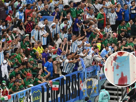 Impactante: un hincha argentino mostró cómo le quedó la cara tras la pelea con los mexicanos