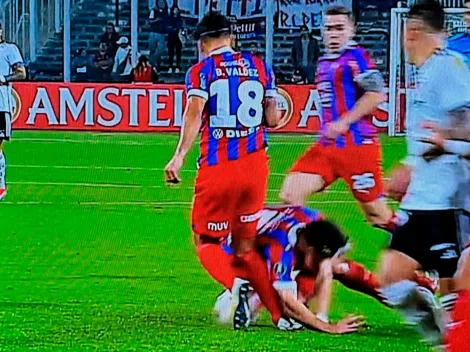 No apto para impresionables: escalofriante lesión de Bruno Valdez