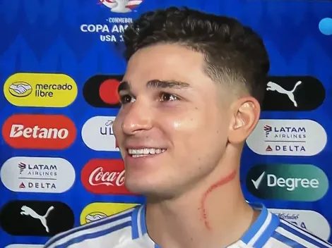 El impactante rasguño que le hicieron a Julián Álvarez: "A veces toca luchar"