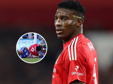 Se golpeó jugando en la Premier League, tuvo que ser operado de urgencia y quedó internado en coma inducido