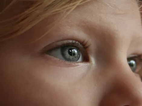 Retinoblastoma: entenda o que é, como identificar e quais são os sintomas da doença rara que atinge crianças